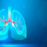 CT imaging used to detect and diagnose lung nodules