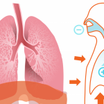 Adenocarcinoma in situ is no longer classified as cancer